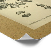 1850 Vintager Anatomie Druckfussknöchel Poster (Ecke)