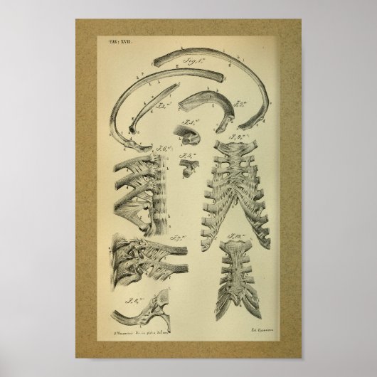 1850 Vintager Anatomie Druckkäfig Poster (Vorne)