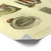 1866 Human Eye Anatomy Print Poster (Ecke)