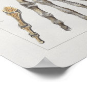 1867 Handknochen Vintage Anatomie drucken Poster (Ecke)