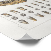 1867 Jaw Teeth Dental Vintag Anatomy Print Poster (Ecke)