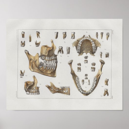 1867 Jaw Teeth Dental Vintag Anatomy Print Poster (Vorne)