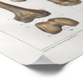 1867 Leg Femurknochen Vintage Anatomie drucken Poster (Ecke)