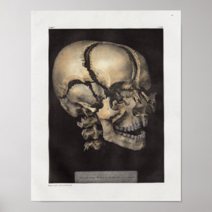 1867 Menschlicher Schädel Vintage Anatomie Druck Poster