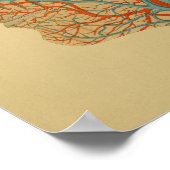 1879 Vintage Anatomie Druckkopfgefäße Poster (Ecke)