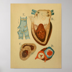 1879 Vintage Anatomie Print Human Heart Internal Poster
