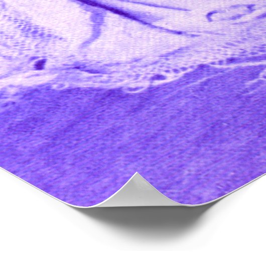 1928 Ziegfeld Poster (Ecke)