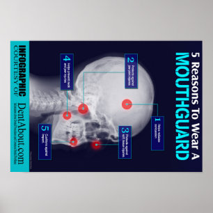 5 Gründe, einen Mouthguard zu tragen Poster