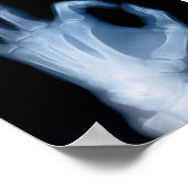 A-OK X-RAY POSTER (Ecke)