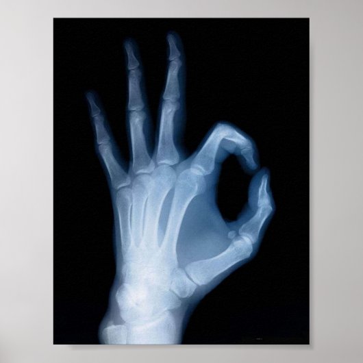 A-OK X-RAY POSTER (Vorne)