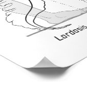 Abnormal Curves of the Spine Poster Chiropractic (Ecke)