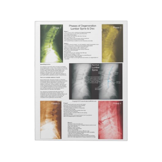 Abreißen der Pad Lumbar Spinalentzündung Notizblock (Rotiert)