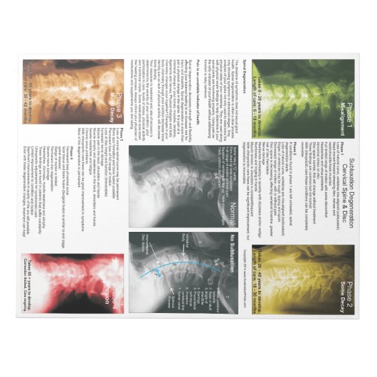 Abreißen von Pad Subluxation Zervikalische Entkern Notizblock (Vorderseite)