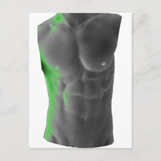 Abs Postkarte (Vorderseite)