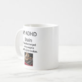 ADHD Turboladung Gehirn mit Fahrradbremsen Tasse (Vorderseite Links)