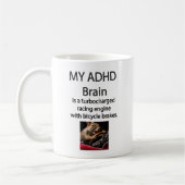 ADHD Turboladung Gehirn mit Fahrradbremsen Tasse (Links)