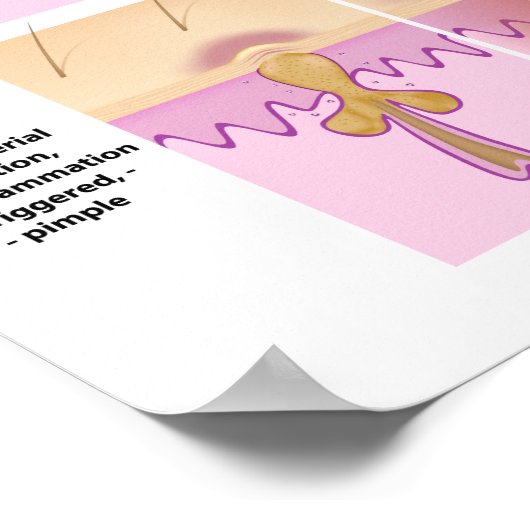 Akne der Haut und Pimples Poster (Ecke)