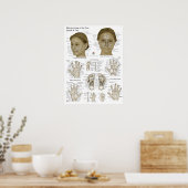 Akupressurpunkte Gesicht Hand Füße Poster (Küche)