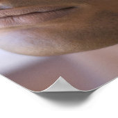 Akupunktur. Akupunkturist, der eine Nadel einführt Poster (Ecke)