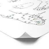 Akupunktur Behandlung von Schmerzen und Kopfschmer Poster (Ecke)