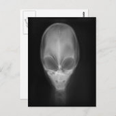 Alien Skull Röntgen Postkarte (Vorne/Hinten)