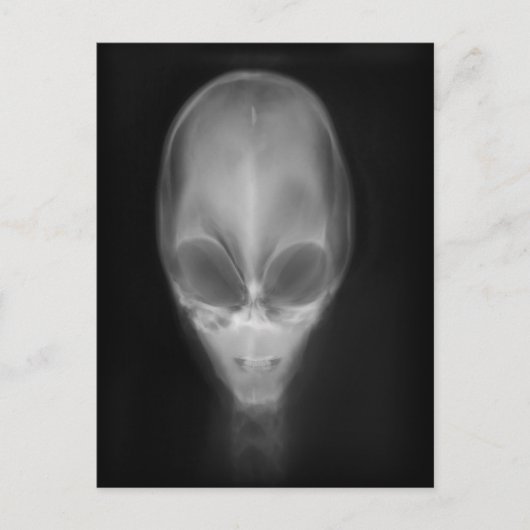 Alien Skull Röntgen Postkarte (Vorderseite)