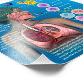 Allergien: IgE-Entzündungsreaktionposter Fotodruck (Ecke)