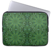 Aloe There Laptopschutzhülle (Vorderseite)
