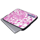 Aloha 15in Laptop-Hülse Laptopschutzhülle (Vorne Knopf)