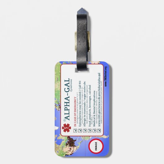 Alpha-gal-Syndrom - Anpassbare Arbeits-/Gepäckmark Gepäckanhänger (Rückseite vertikal)