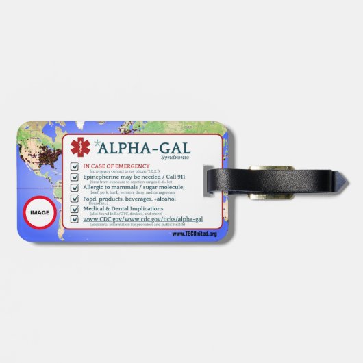 Alpha-gal-Syndrom - Anpassbare Arbeits-/Gepäckmark Gepäckanhänger (Rückseite horizontal)