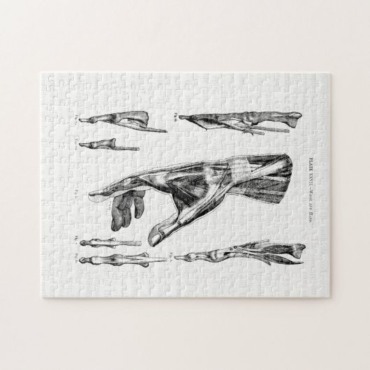 Alte Anatomie KunstMuskeln der Hand und des Handge Puzzle (Horizontal)