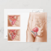 Anatomie der Blasenaufhängung Postkarte (Vorne/Hinten)