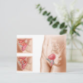 Anatomie der Blasenaufhängung Postkarte (Stehend Vorderseite)
