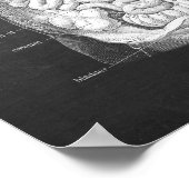 Anatomie der Darmkrankheit Gastroenterologin Decor Poster (Ecke)