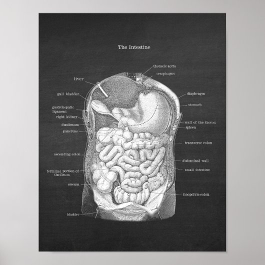 Anatomie der Darmkrankheit Gastroenterologin Decor Poster (Vorne)