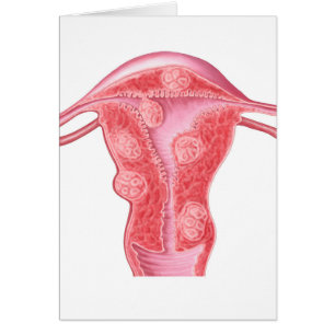 Anatomie der faserartigen Tumoren in der