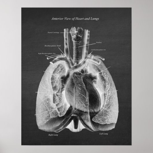 Anatomie der Lunge Herzanterieansicht Poster (Vorne)