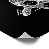 Anatomie der menschlichen Wirbelsäule in Schwarzwe Poster (Ecke)