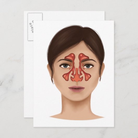Anatomie der Nasennebenhöhlen Postkarte (Vorne/Hinten)