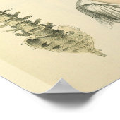 Anatomie der Spinalspalte Drucken Poster (Ecke)