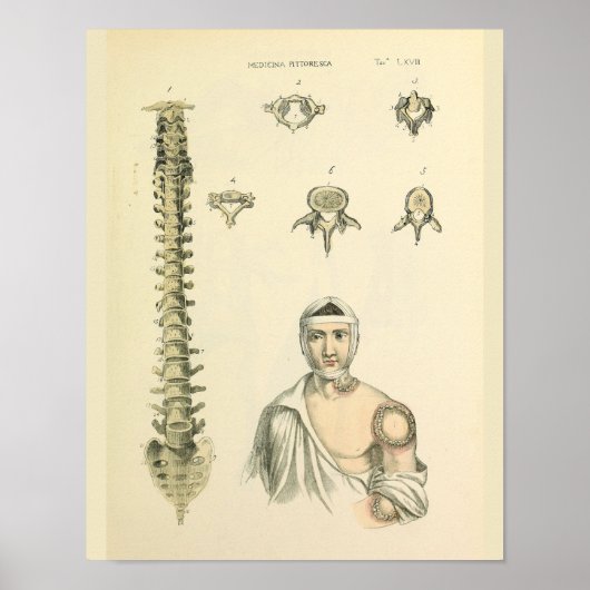 Anatomie der Spinalspalte Drucken Poster (Vorne)