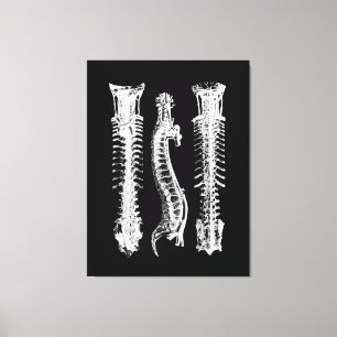 Anatomie der Spine Große Leinwand Kunst