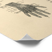 Anatomie der Vintagen Arme 1880 drucken Poster (Ecke)