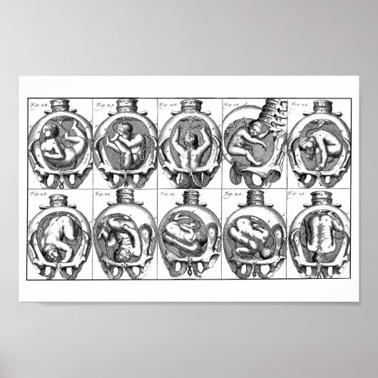 Anatomie des Babys in der Gebärmutter Vintag Poster (Vorne)