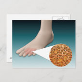Anatomie des Foot Fungus mit mikroskopischer Nah-u Postkarte (Vorne/Hinten)