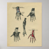 Anatomie des Handarms 1902 Vintag Poster (Vorne)