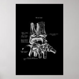 Anatomie des Handgelenks Medizinisches Poster Orth