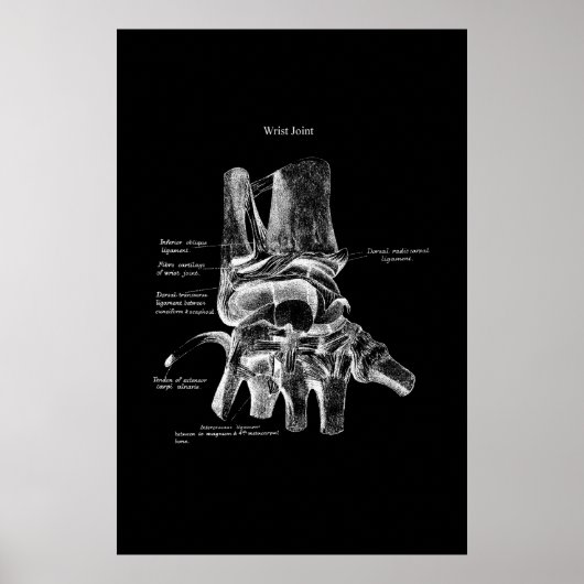 Anatomie des Handgelenks Medizinisches Poster Orth (Vorne)