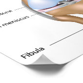 Anatomie des Kniegelenks Poster (Ecke)